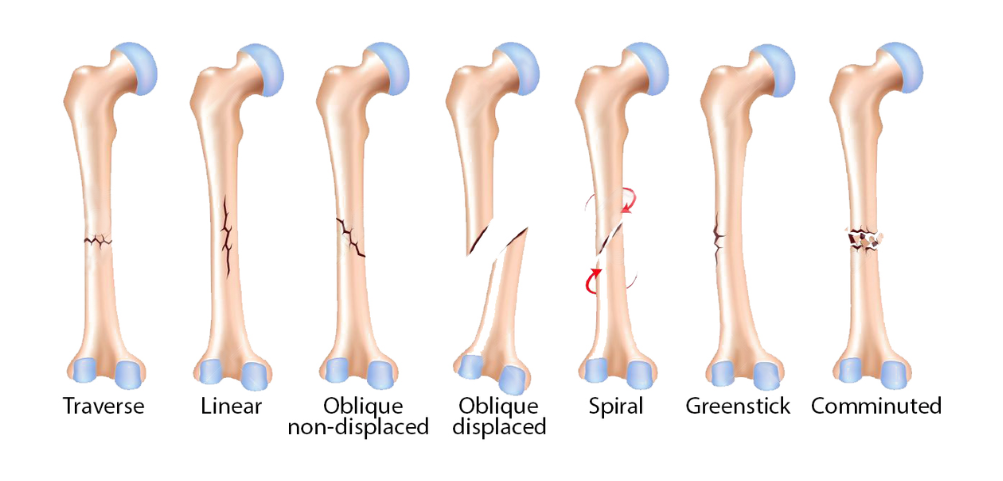 SP-health corner (9).png