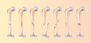 SP-health corner (11).png